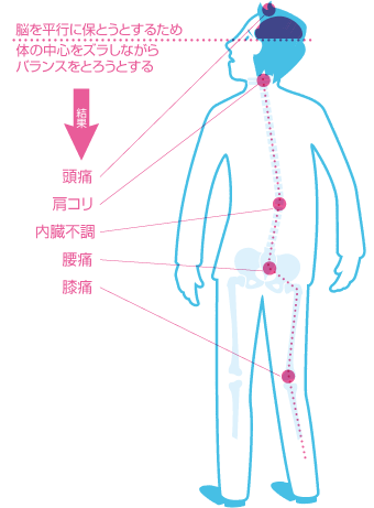 中心バランスが崩れて起こる不調