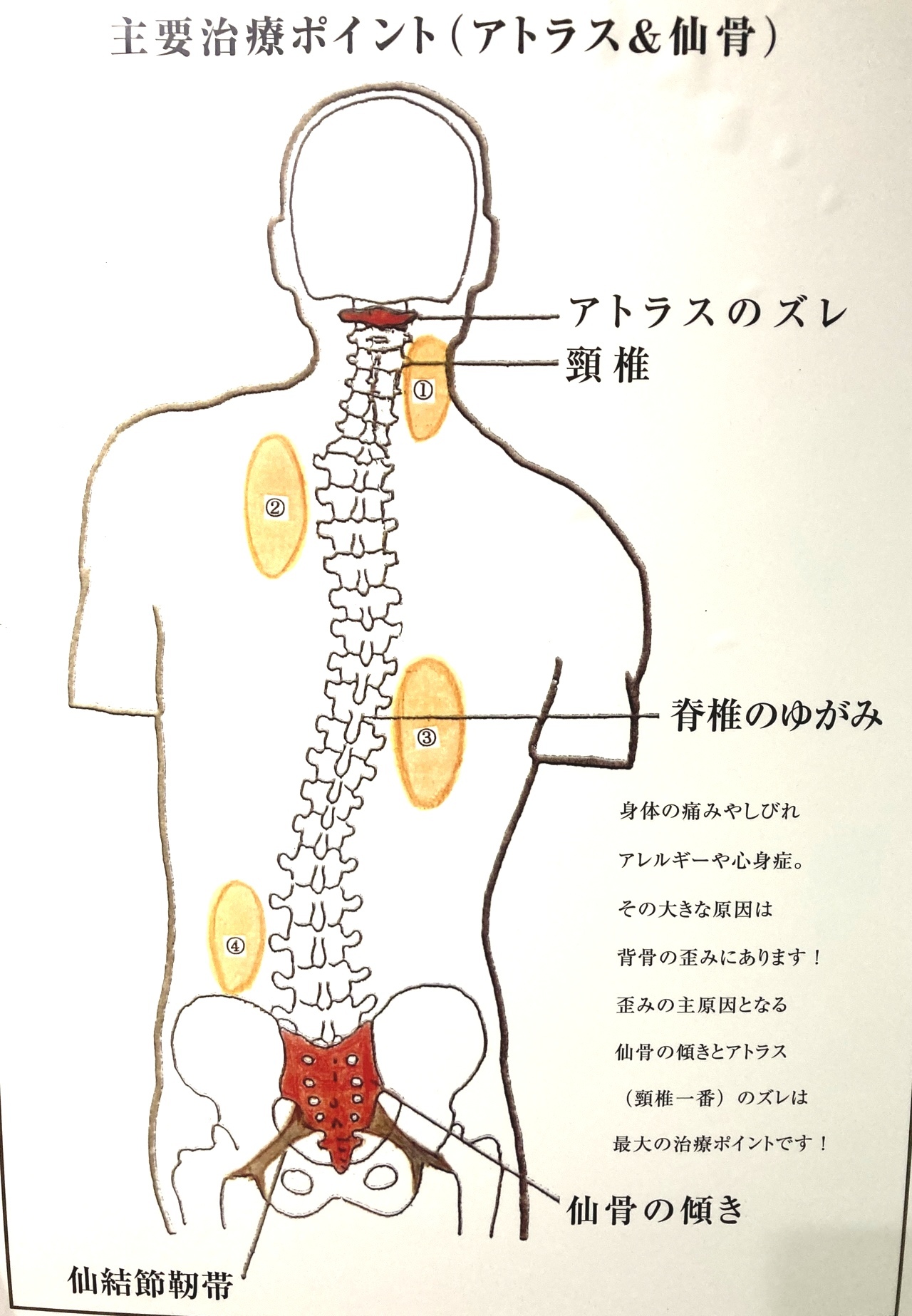 治療ポイント（第一頸椎＆仙骨）