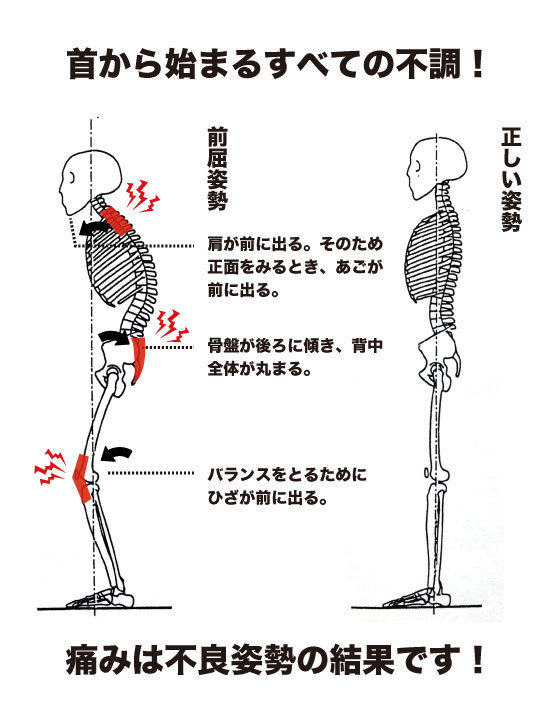 首から始まるすべての不調